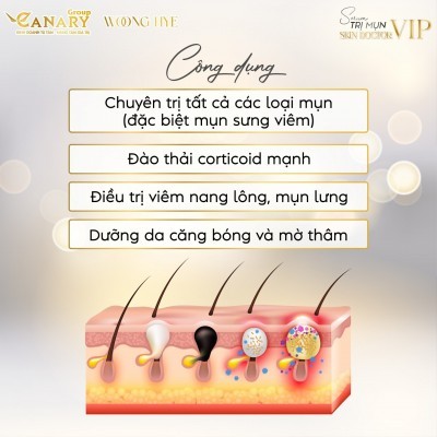 Serum trị mụn Dr. VIP (Black) 12ml - Skin Doctor VIP - WOONGHYE