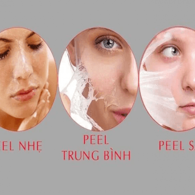 VI PEEL MEK 1  ĐƯA LÀN DA BẠN SANG 1 TRANG MỚI